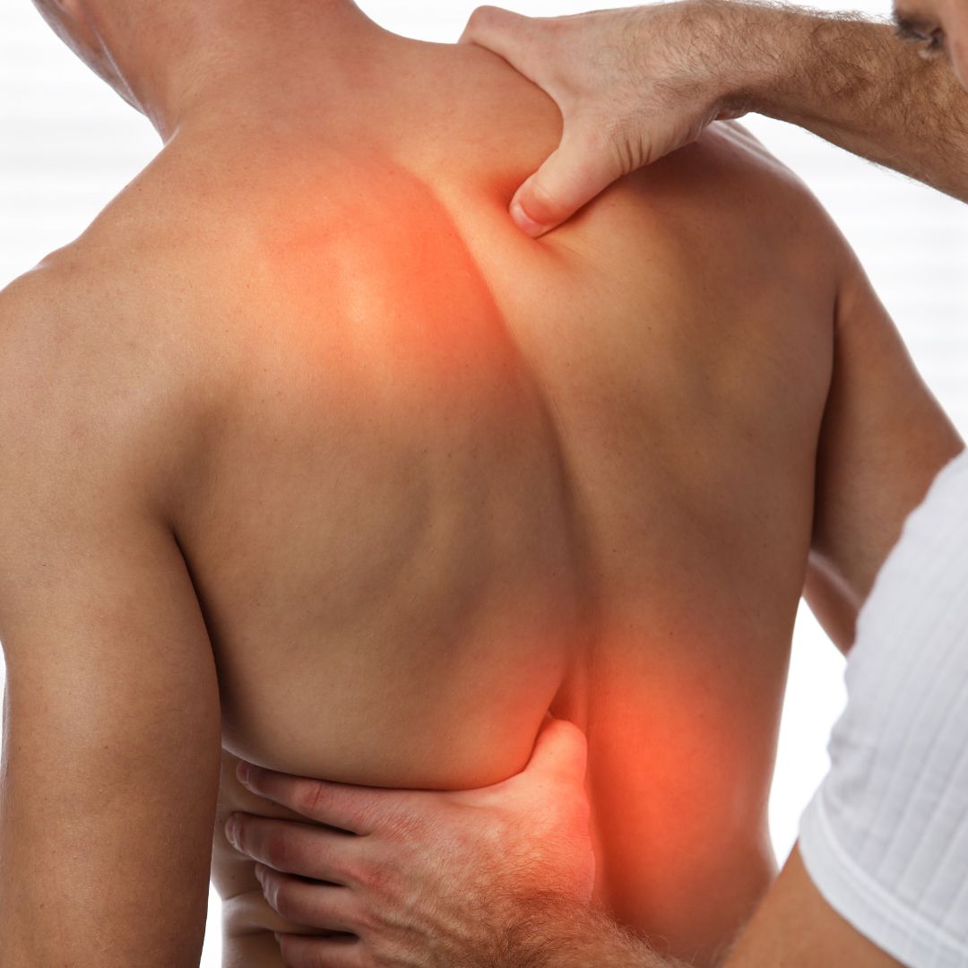 MSK Treatment